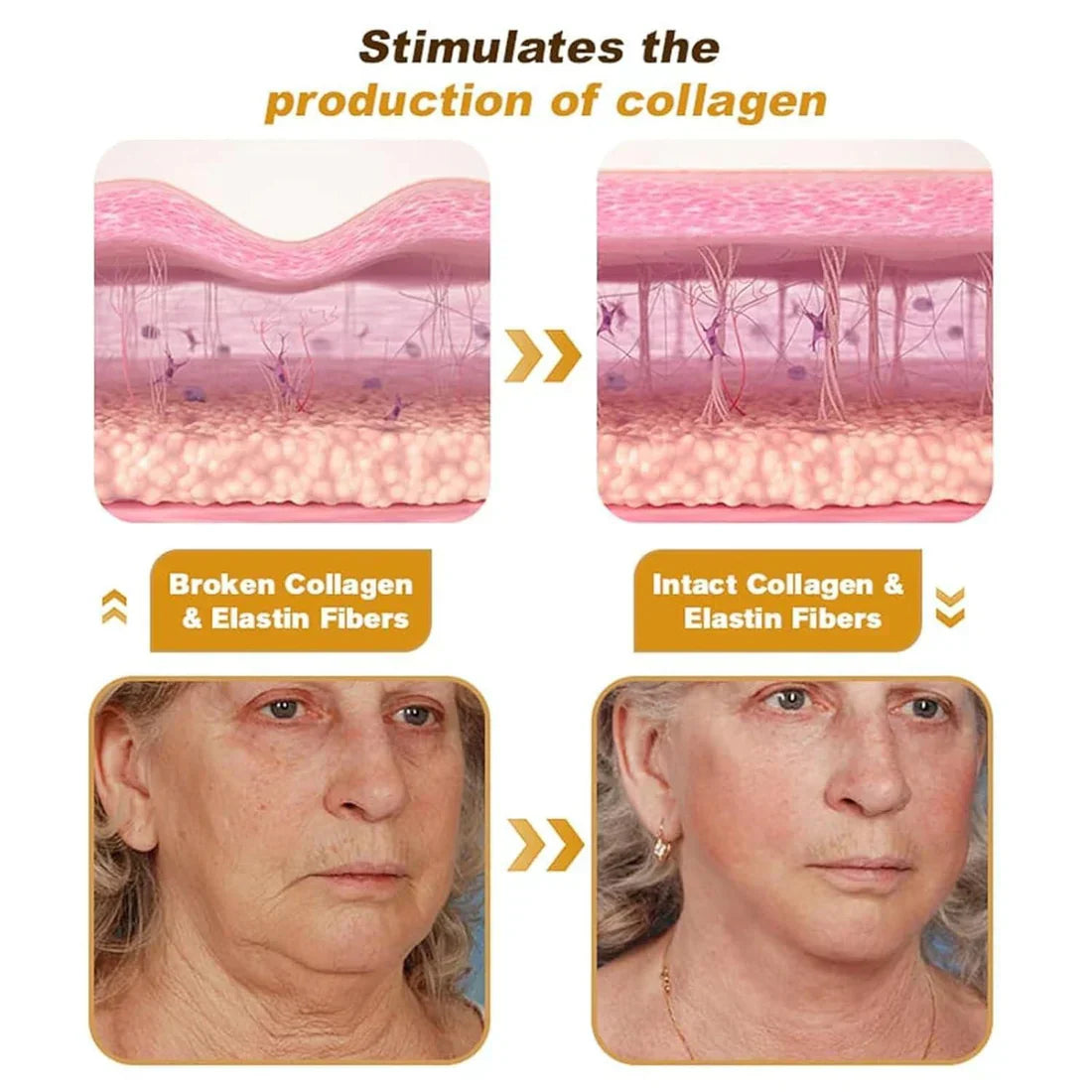 Bee Venom Wrinkle Repair Cream