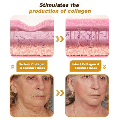 Bee Venom Wrinkle Repair Cream