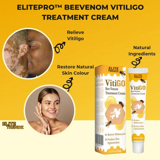 BEE VENOM VITILIGO TREATMENT CREAM